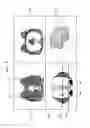 Fig. 09 - MEDICAL IMAGING APPARATUS AND METHOD OF PROCESSING MEDICAL IMAGE