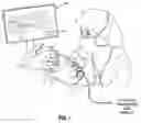 Fig. 02 - Ocular micro tremor (OMT) sensor, system and method