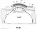 Fig. 04 - Ocular micro tremor (OMT) sensor, system and method