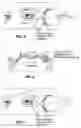 Fig. 05 - Ocular micro tremor (OMT) sensor, system and method