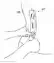 Fig. 01 - Posture mapping and posture monitoring system and method