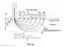 Fig. 113 - SYSTEMS AND METHODS FOR NONINVASIVE BLOOD GLUCOSE AND OTHER ANALYTE DETECTION AND MEASUREMENT USING COLLISION COMPUTING