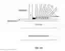 Fig. 173 - SYSTEMS AND METHODS FOR NONINVASIVE BLOOD GLUCOSE AND OTHER ANALYTE DETECTION AND MEASUREMENT USING COLLISION COMPUTING