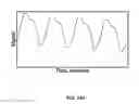 Fig. 201 - SYSTEMS AND METHODS FOR NONINVASIVE BLOOD GLUCOSE AND OTHER ANALYTE DETECTION AND MEASUREMENT USING COLLISION COMPUTING