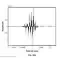 Fig. 89 - SYSTEMS AND METHODS FOR NONINVASIVE BLOOD GLUCOSE AND OTHER ANALYTE DETECTION AND MEASUREMENT USING COLLISION COMPUTING