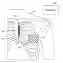 Fig. 01 - Methods and devices combining multiple cardiac rate measurements with interval correction and arrhythmia decision bypass