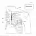 Fig. 01 - Methods and devices combining multiple cardiac rate measurements with activation and arrhythmia analysis correction