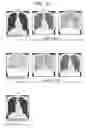 Fig. 09 - Radiation image photographing system
