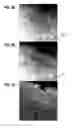 Fig. 09 - Techniques for suppression of motion artifacts in medical imaging