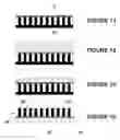 Fig. 10 - Forward-looking ultrasound array probe for intravascular imaging and navigation applications