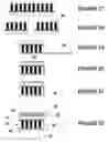 Fig. 11 - Forward-looking ultrasound array probe for intravascular imaging and navigation applications