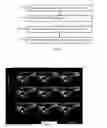 Fig. 02 - Image-based user interface for controlling medical imaging