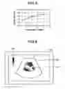 Fig. 04 - Analyzing apparatus