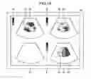Fig. 10 - Analyzing apparatus