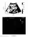 Fig. 06 - Analysis methods of ultrasound echo signals based on statistics of scatterer distributions
