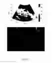 Fig. 09 - Analysis methods of ultrasound echo signals based on statistics of scatterer distributions