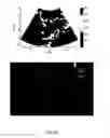 Fig. 12 - Analysis methods of ultrasound echo signals based on statistics of scatterer distributions