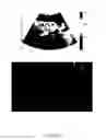 Fig. 19 - Analysis methods of ultrasound echo signals based on statistics of scatterer distributions