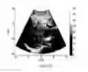 Fig. 24 - Analysis methods of ultrasound echo signals based on statistics of scatterer distributions