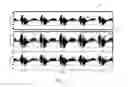 Fig. 07 - Data compression to facilitate remote medical analysis and diagnosis