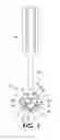 Fig. 06 - Stand-alone access system for minimally invasive spinal surgery