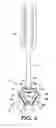 Fig. 07 - Stand-alone access system for minimally invasive spinal surgery