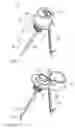 Fig. 02 - Devices and methods for anchoring tissue