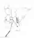 Fig. 12 - Devices and methods for anchoring tissue