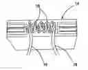 Fig. 01 - All-suture suture anchor systems and methods