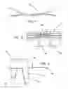 Fig. 02 - All-suture suture anchor systems and methods