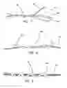 Fig. 04 - All-suture suture anchor systems and methods