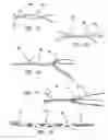 Fig. 06 - All-suture suture anchor systems and methods