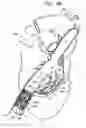 Fig. 07 - Tissue anchor and delivery tool