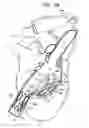 Fig. 09 - Tissue anchor and delivery tool