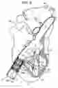 Fig. 16 - Tissue anchor and delivery tool