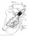 Fig. 19 - Tissue anchor and delivery tool