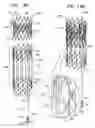 Fig. 30 - Tissue anchor and delivery tool