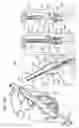 Fig. 35 - Tissue anchor and delivery tool
