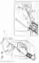 Fig. 40 - Tissue anchor and delivery tool