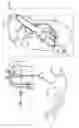 Fig. 48 - Tissue anchor and delivery tool
