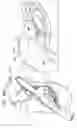 Fig. 50 - Tissue anchor and delivery tool