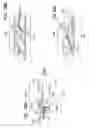 Fig. 56 - Tissue anchor and delivery tool