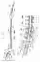 Fig. 57 - Tissue anchor and delivery tool