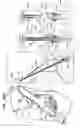 Fig. 59 - Tissue anchor and delivery tool