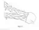 Fig. 05 - Systems for securing sutures