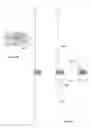 Fig. 35 - ANCHOR DELIVERY SYSTEM