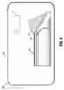 Fig. 08 - Surgical stapler flexible distal tip