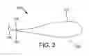 Fig. 04 - High-strength bioabsorbable suture