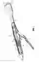 Fig. 02 - Surgical stapling apparatus