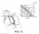 Fig. 03 - COORDINATED DELIVERY OF COPD TREATMENT